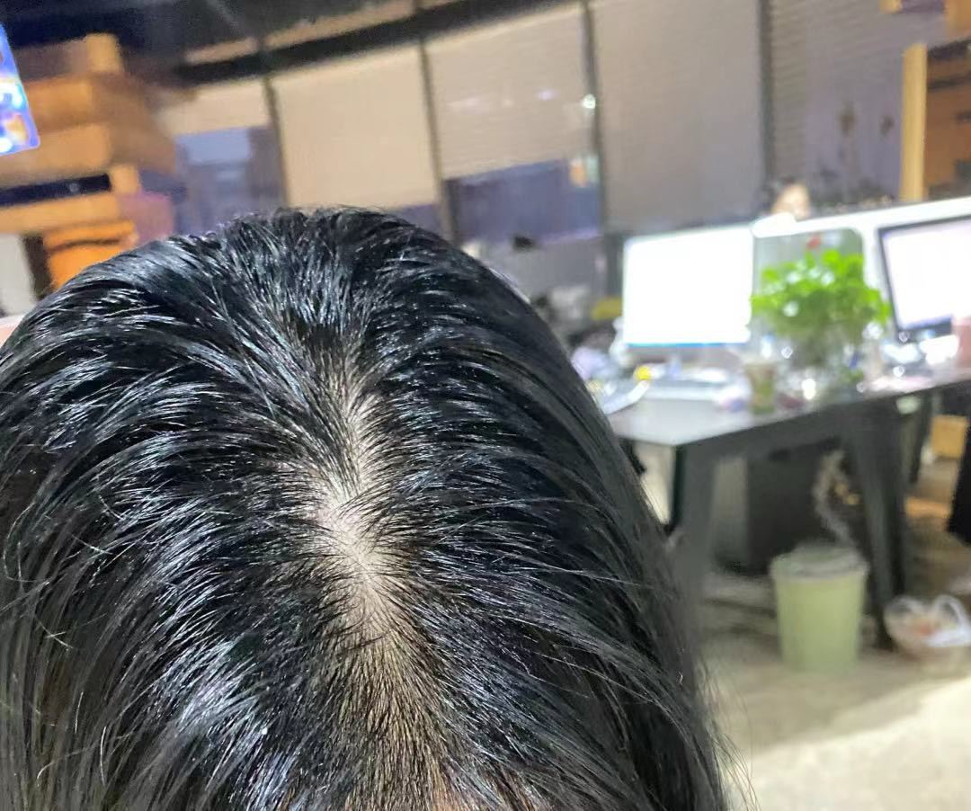 油性洗发水什么牌子好(推荐4款控油又养发洗发水)