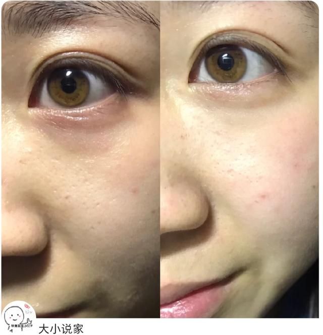 4大贵妇眼霜成分分析！兰蔻菁纯淡纹最好，海蓝之谜成分最实在