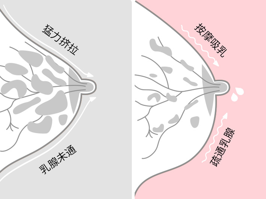 吸奶器的正确使用方法和误区（吸奶器演示教程）