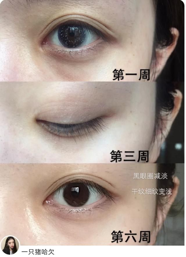 4大贵妇眼霜成分分析！兰蔻菁纯淡纹最好，海蓝之谜成分最实在