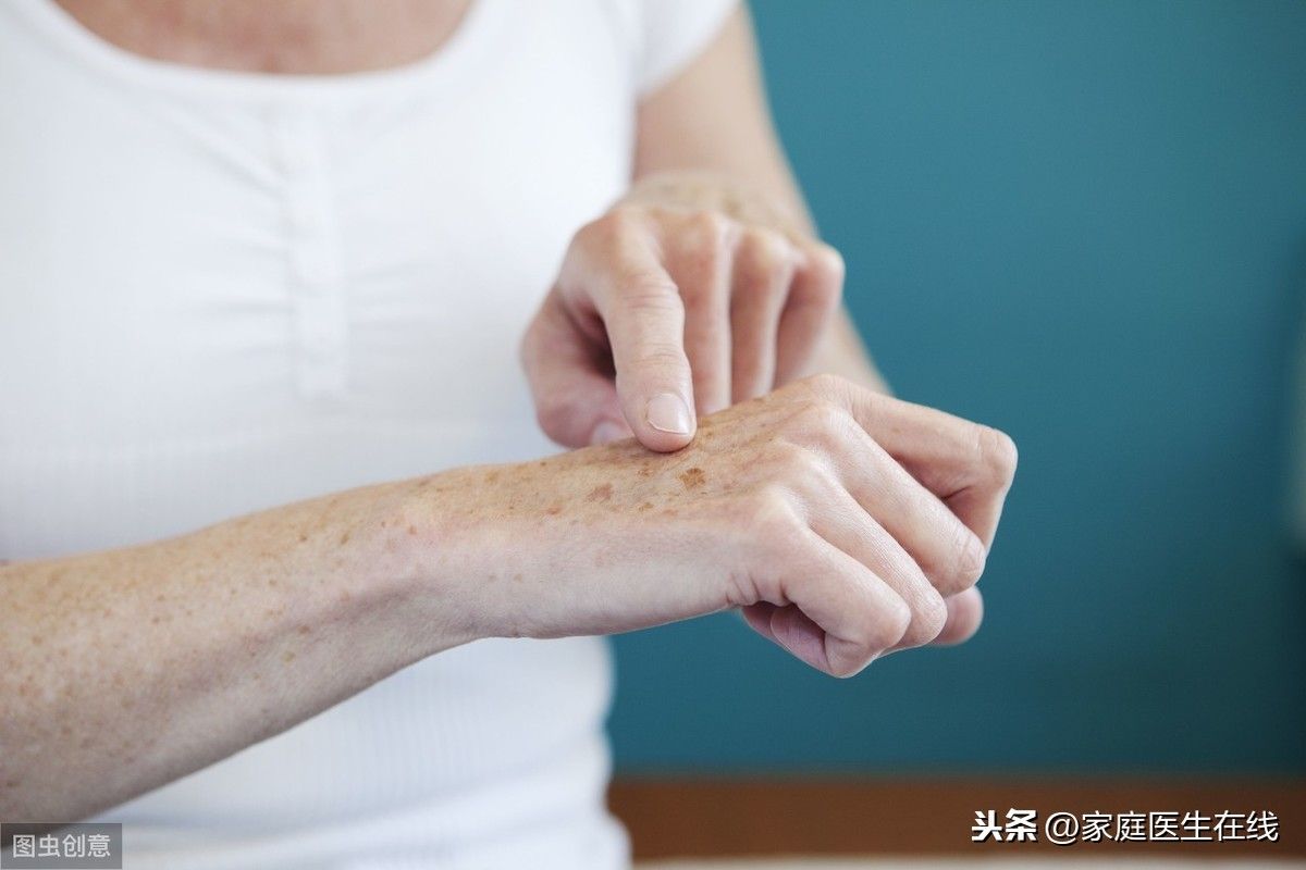 老年斑是什么原因引起的(4个原因形成老年斑)